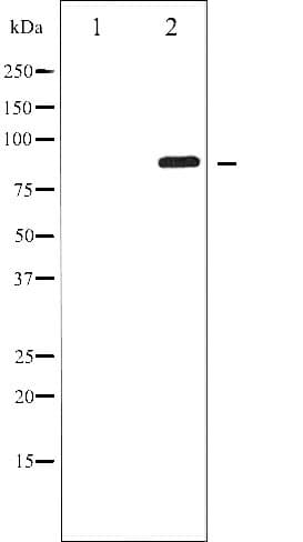 GRIA2 / GLUR2 Antibody (phospho-Ser880)