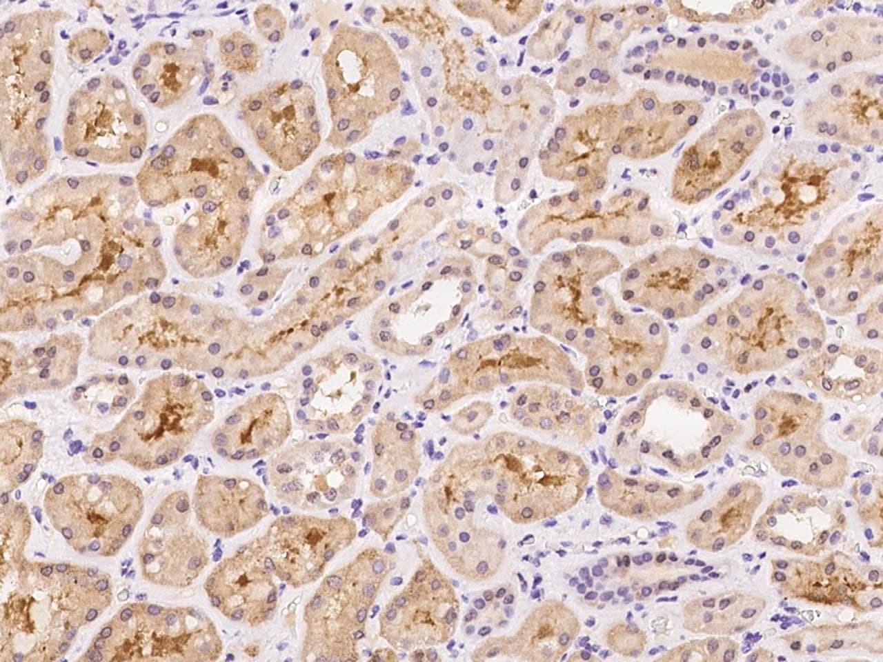 Polyclonal Rabbit anti-Human BEX4 Antibody (IHC)