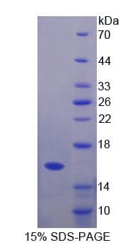 Mouse GHRH Protein (Recombinant His)
