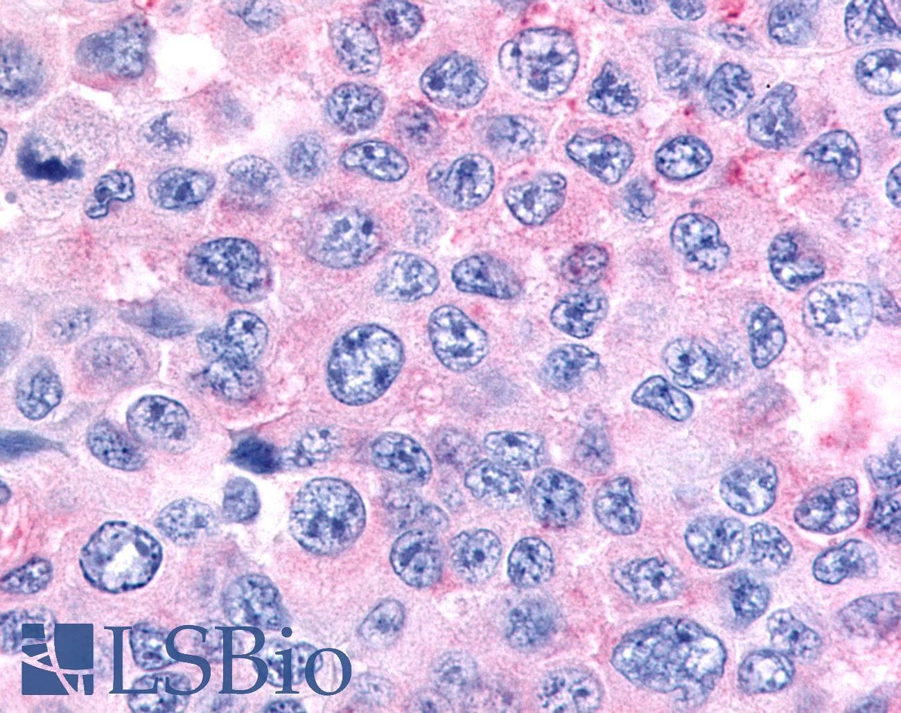 PathPlus™ Polyclonal Rabbit anti-Human NR6A1 / GCNF Antibody (Ligand-binding Domain, IHC)