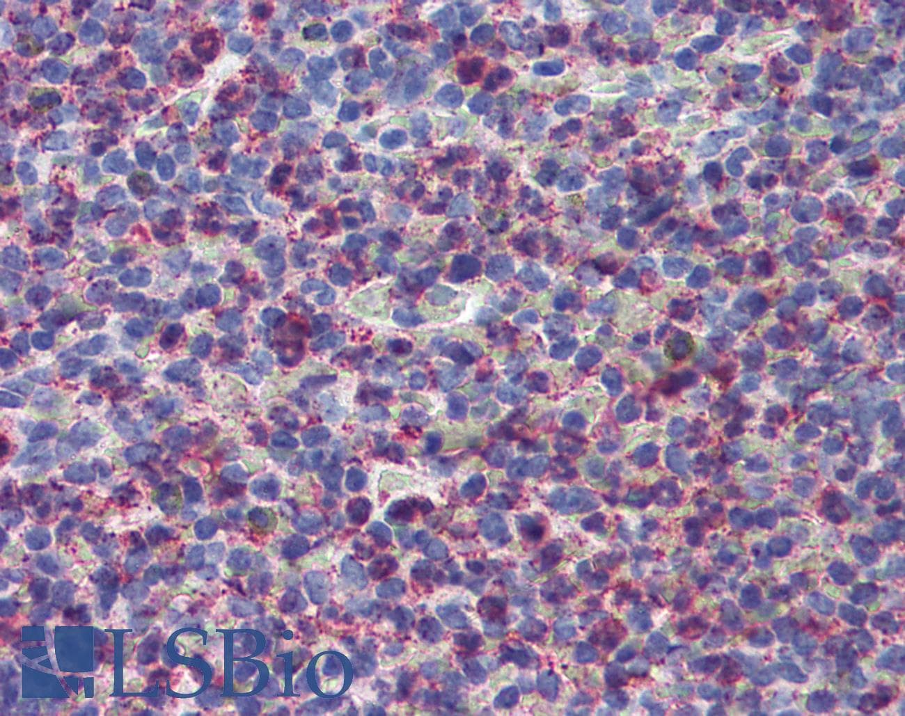 IHC-plus™ CYSLT2 / CYSLTR2 Antibody (Extracellular Domain)