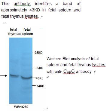 IHC-plus™ CAPG Antibody