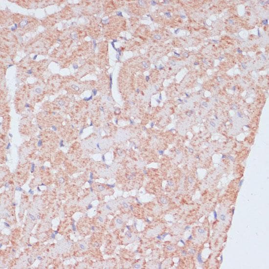 Polyclonal Rabbit anti-Human MZB1 Antibody (IHC)