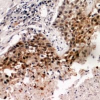 TBPL2 / TRF3 Antibody