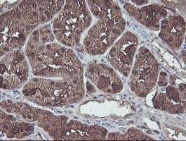 ACY1 / Aminoacylase 1 Antibody (clone OTI2F1)