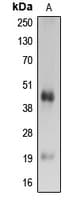 Polyclonal Rabbit anti-Human CASP4 / Caspase 4 Antibody (Internal, WB)