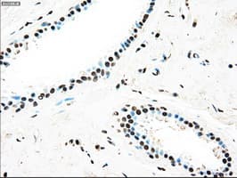 TYRO3 Antibody (clone OTI2C4)