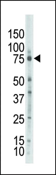 PRKCZ / PKC-Zeta Antibody (aa166-197)