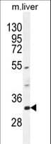 FAM78B Antibody (aa77-103)