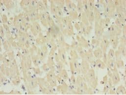 STRADB / ALS2CR2 Antibody