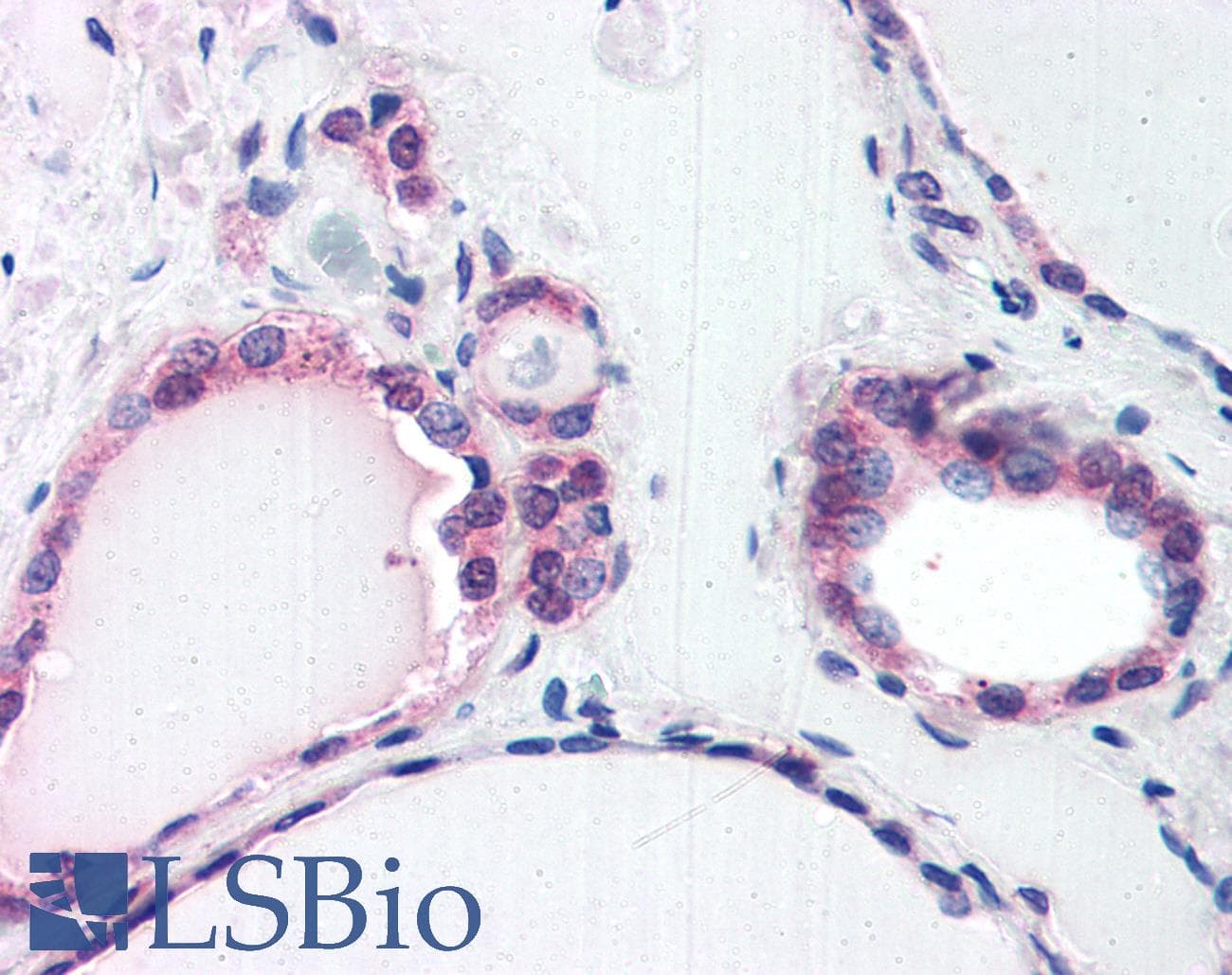 IHC-plus™ Polyclonal Goat anti-Human COPS2 / TRIP15 / ALIEN Antibody (aa439-451, IHC, WB)