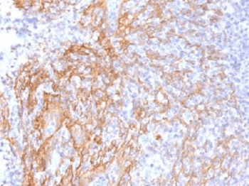 CTNNB1 / Beta Catenin Antibody (clone 6F9, Azide-free, BSA-free)