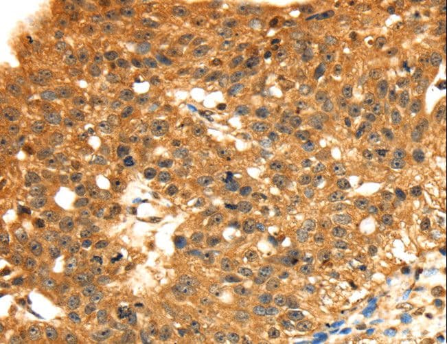STX8 / Syntaxin 8 Antibody