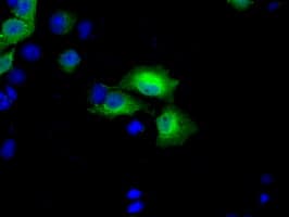 BDH2 Antibody (clone OTI4G4)