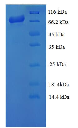 Giardia lamblia Endoribonuclease Dicer-Like Protein (Recombinant His-SUMO)