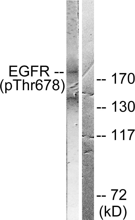 EGFR Antibody (phospho-Thr678)