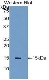 PPARG / PPAR Gamma Antibody (aa157-274)