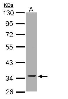 IHC-plus™ DECR1 Antibody (aa1-335)