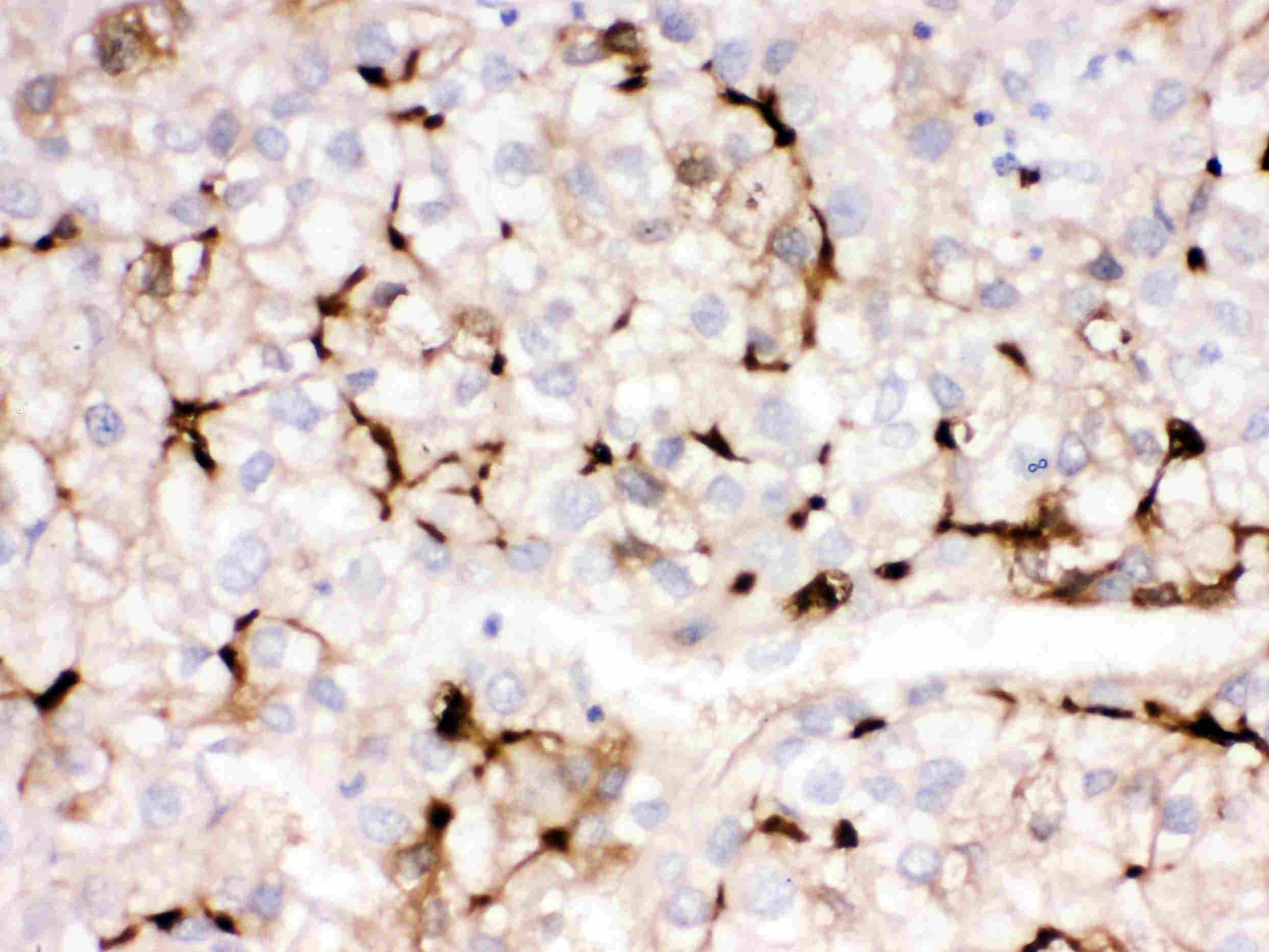 APOA1 / Apolipoprotein A 1 Antibody