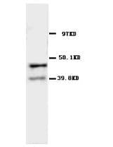 CHRNA1 Antibody (N-Terminus)