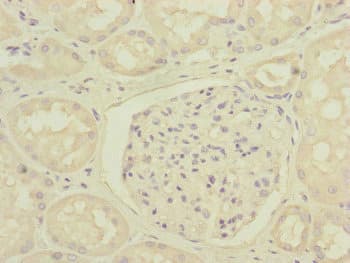 Polyclonal Rabbit anti-Human DCTN6 / Dynactin 6 Antibody (IHC, WB)