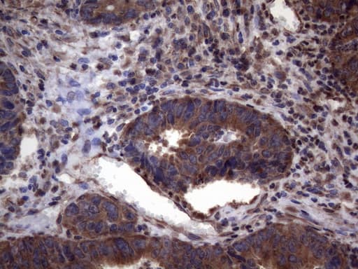 DJ858B16.2 / PISD Antibody (aa80-340, clone OTI6C3)