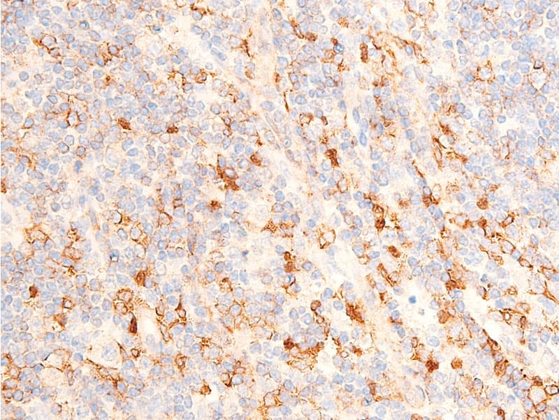 Polyclonal Rabbit anti-Human CHEK1 / CHK1 Antibody (phospho-Ser317, IHC, IF, WB)