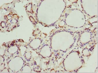Peripherin Antibody (aa1-260)
