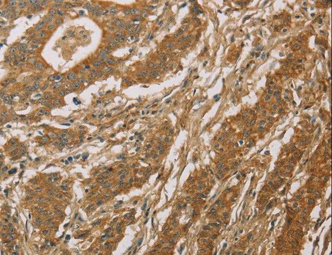 CYP39A1 Antibody