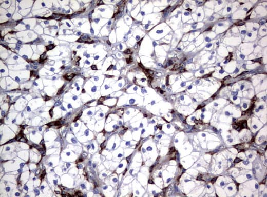FCGR1A / CD64 Antibody (clone UMAB74, Carrier-free)