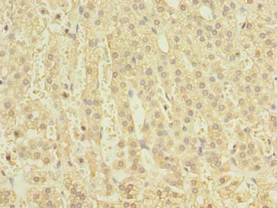 Polyclonal Rabbit anti-Human CLEC4C / CD303 / BDCA-2 Antibody (IHC)