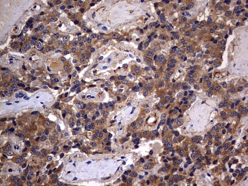IL1RN Antibody (clone OTI3B1)