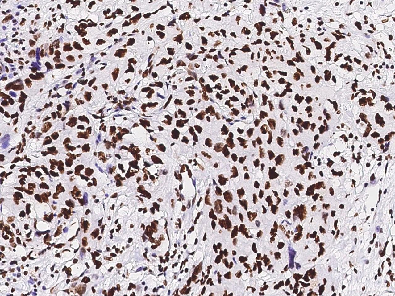 Polyclonal Rabbit anti-Human PAX2 Antibody (Preservative Free, IHC, IF, WB)