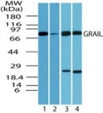 RNF128 / GRAIL Antibody (aa227-253)