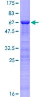 Human ING1 Protein (Recombinant GST)