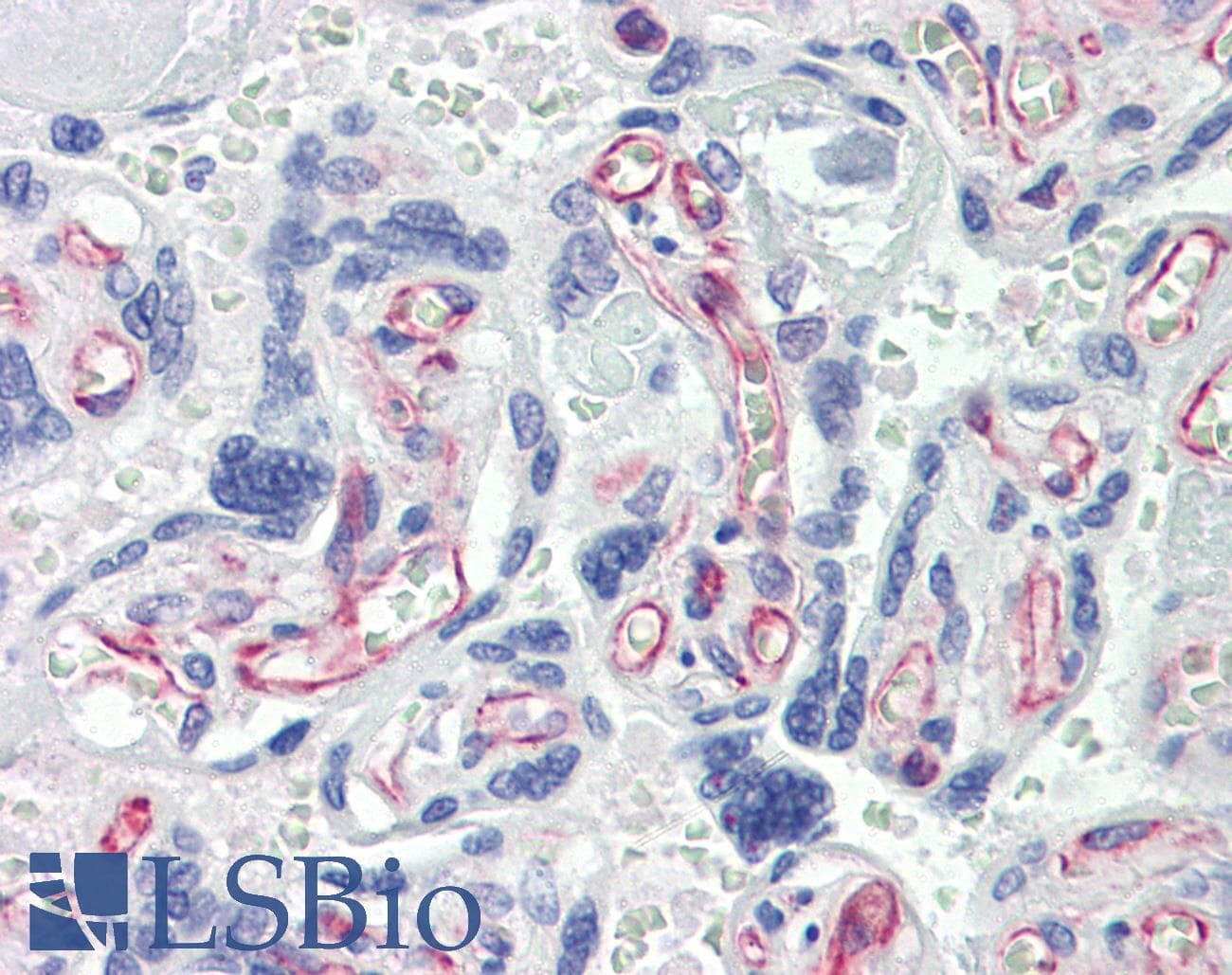 IHC-plus™ Monoclonal Mouse anti-Human CASP7 / Caspase 7 Antibody (clone 7-1-11, IHC, WB)