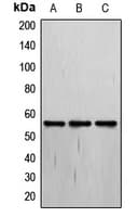 THRA / THR Alpha Antibody (N-Terminus)