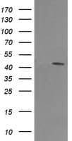 MAP2K1 / MKK1 / MEK1 Antibody (clone OTI6C6)