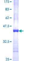 Human FADS1 Protein (Recombinant GST, N-terminus)