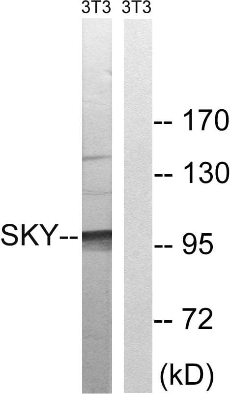 Polyclonal Rabbit anti-Human MER / MERTK Antibody (p749/681, IHC, WB)