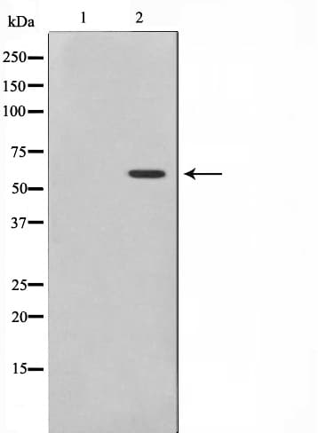 MAPKAPK5 / PRAK Antibody (phospho-Thr182)