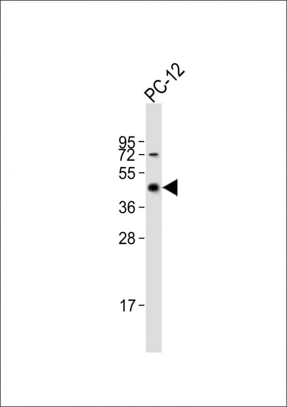 MAP2K7 / MEK7 Antibody (aa325-360)