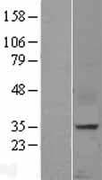 Human CXCL16 Protein (Over-Expression Lysate Myc-DDK (Flag))