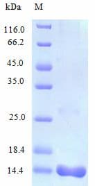 Human CCL25 / TECK Protein (Recombinant)