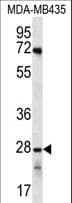 Polyclonal Rabbit anti-Human OR10AG1 Antibody (aa235-263, WB)