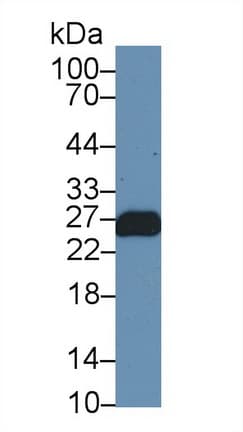 TNNI1 Antibody (aa1-187)