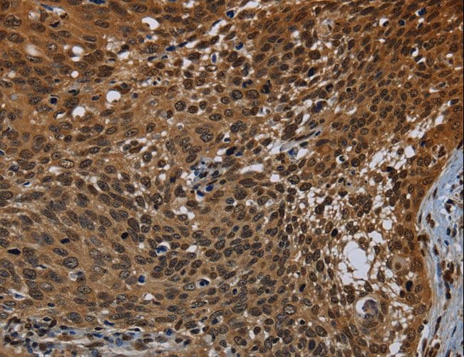 Polyclonal Rabbit anti-Human KDM4B / JMJD2B Antibody (IHC)