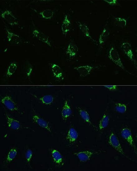 Polyclonal Rabbit anti-Human ATP5I Antibody (IHC, IF)