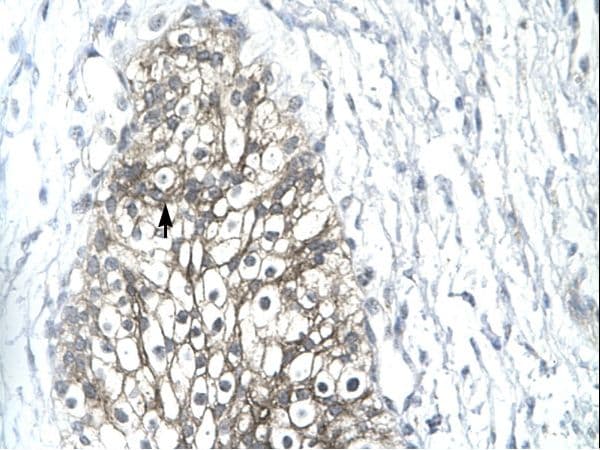 MMP19 Antibody (aa349-398)