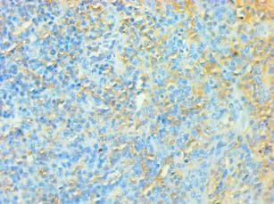 TFEB Antibody (aa1-220)